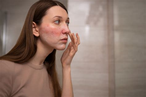 alergia en la  por  salen ronchas en el rostro