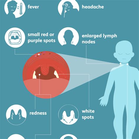 strep throat signs symptoms and complications