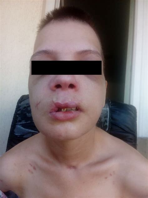 horrific pictures show how 20 year old was forced into