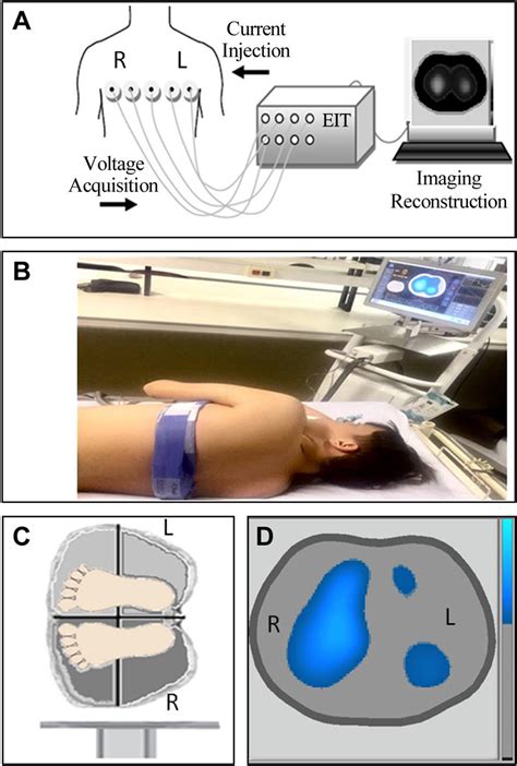 utilization  electrical impedance tomography eit  demonstrate  scientific diagram