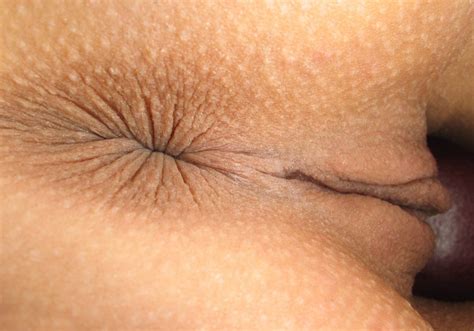 Female Butthole Close Up