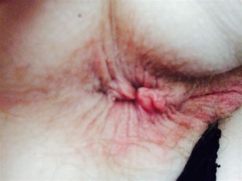 Slut Wife Pussy Asshole Close Up 14 Pics Xhamster