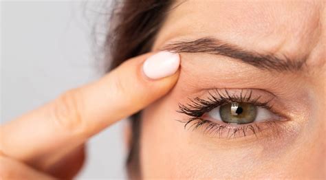 nuevocare cosmetische zorg ooglidcorrectie