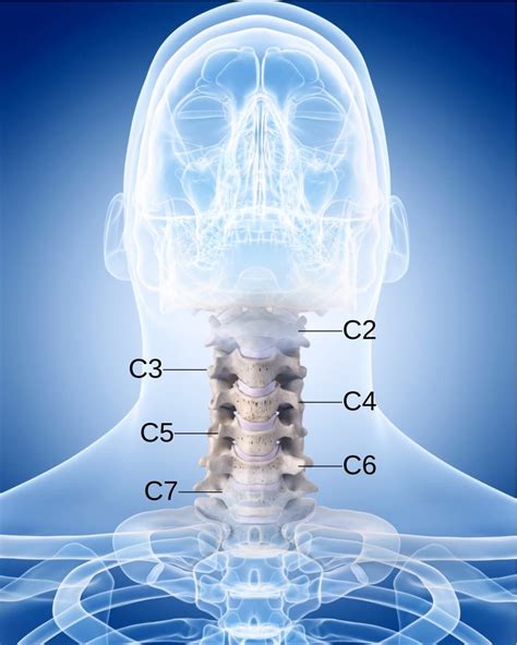 Acdf Anterior Cervical Discectomy And Fusion Uoa Spinal