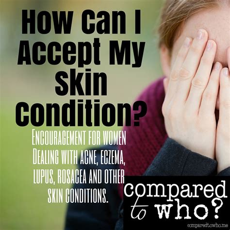 accept  skin condition compared   body image   christians