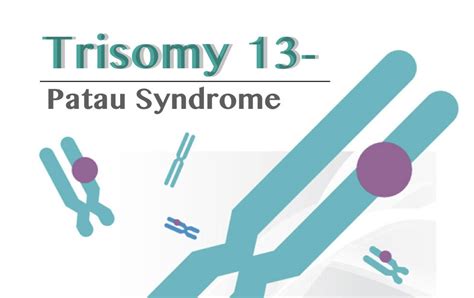Trisomy 13 Patau Syndrome Definition Causes Symptoms Life
