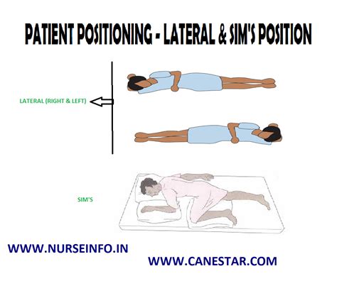 patient positioning lateral sims position nurse info