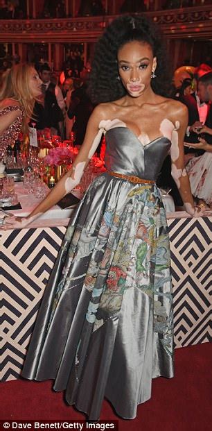Winnie Harlow Puts On A Leggy Display At Fashion Awards