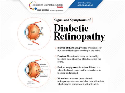 signs  symptoms  diabetic retinopathy