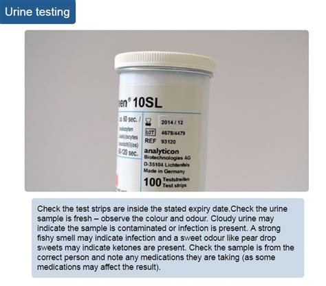 animation    test urine  reagent test strips