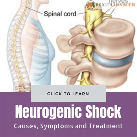 neurogenic shock  picture symptoms  treatment