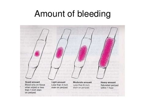 bleeding at 15 weeks pregnant xxx porn library