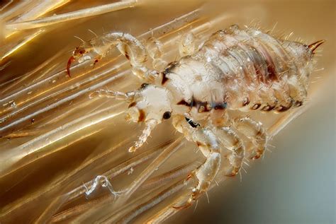 Head Lice Facts ~ Helth