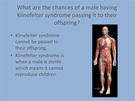 Ppt Klinefelter Syndrome Powerpoint Presentation Id 6730570