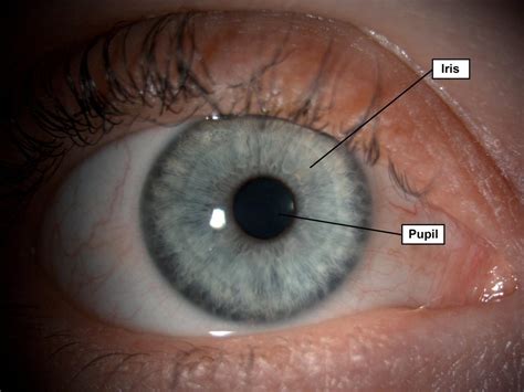 iris  pupil gene vision