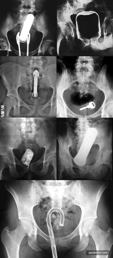 was specially x ray anal porn agree this