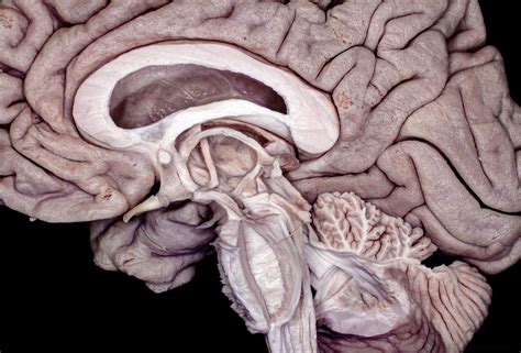 medial perspective  partially dissected brainstem diencephalon  cerebellum neuroanatomy