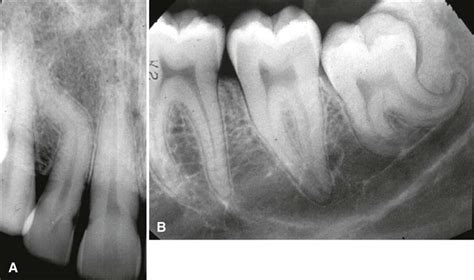 31 Dental Anomalies Pocket Dentistry