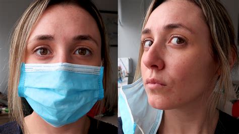 coronavirus pandemic causing  skin issue mask ne aka mask acne glam lab abc  york