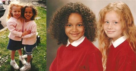 world s first biracial twins are now 18 and see how different they look now