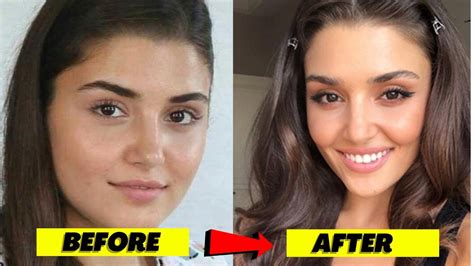turkish actresses    plastic surgery youtube