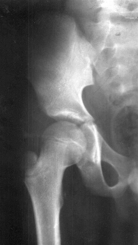x ray penis penetration