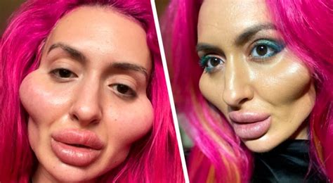 she is 32 years old and addicted to cosmetic surgery she spent £1600