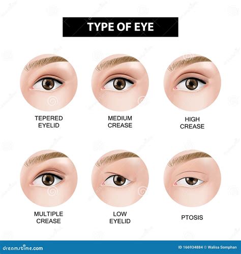 type  eyelid crease stock illustration illustration  infographic