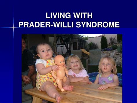Ppt Living With Prader Willi Syndrome Powerpoint Presentation Free