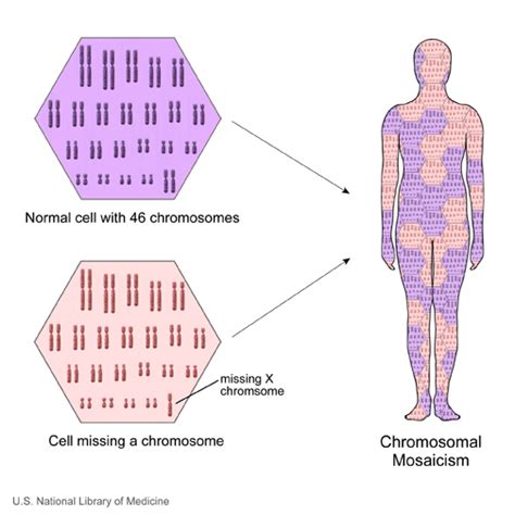Mosaicism Causes Symptoms Treatment Mosaicism