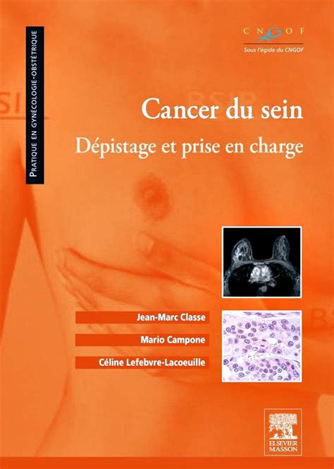 Cancer Du Sein Dépistage Et Prise En Charge Télécharger Des