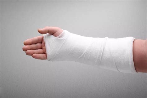 treatment   broken arm austin tx orthopaedic specialists  austin