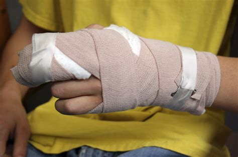 sports injuries hand treatment   orthoindy blog