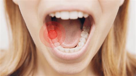 8 Ways To Cure A Toothache Without The Dentist Powerofpositivity