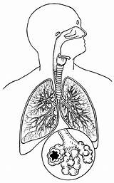 Respiratory Loudlyeccentric sketch template