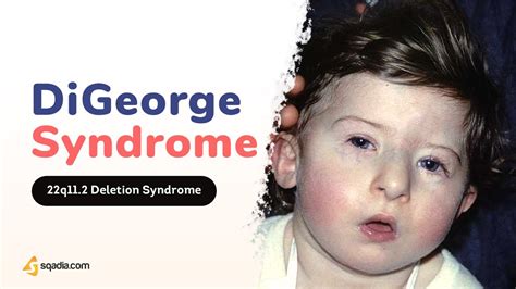 digeorge syndrome pathophysiology  minute neurology video