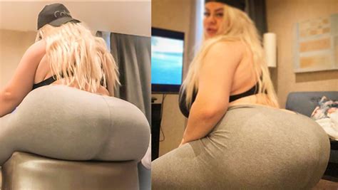 Model Defends Dangerous Surgery To Get Biggest Butt In The