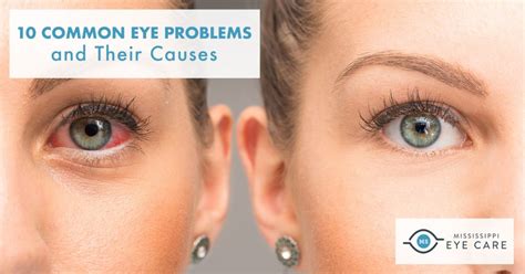 10 Common Eye Problems And Their Causes Mississippi Eye Care
