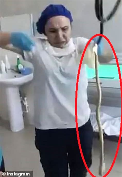فيديو غرفة العمليات لحظة استخراج ثعبان من جسد امرأة