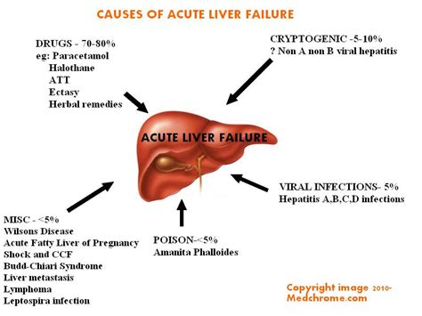 acute liver failure classification  features  management medchrome