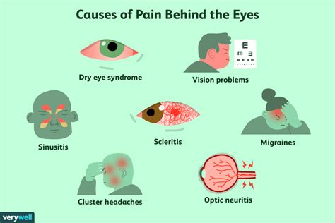 Pain Behind The Eye Symptoms Causes And Treatment My Xxx Hot Girl
