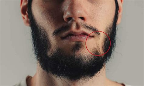 beard won t connect to mustache and sideburns 7 ways to fix it