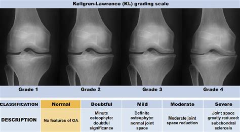 trademed industry news ai could help radiologists improve