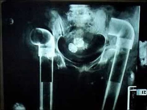 the weirdest x rays ever 20 pics