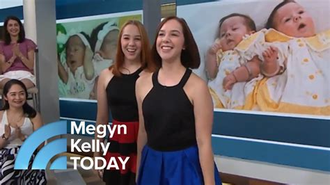 conjoined twin sisters tell their story ‘being by her … it s so calming megyn kelly today