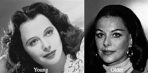 Hedy Lamarr Plastic Surgery Before And After Photos