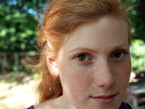 744 Best Images About Freckles And Fair Skin On Pinterest