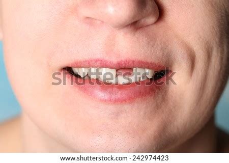 teeth stock  royalty  images vectors shutterstock