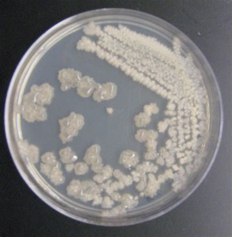dvc microbiology  fall  gard lab  colony morphology