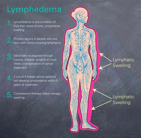 2019 】 🤙 lymphedema images lymphedema rash images ⭐ lymphedema pump images ⭐ mild lymphedema
